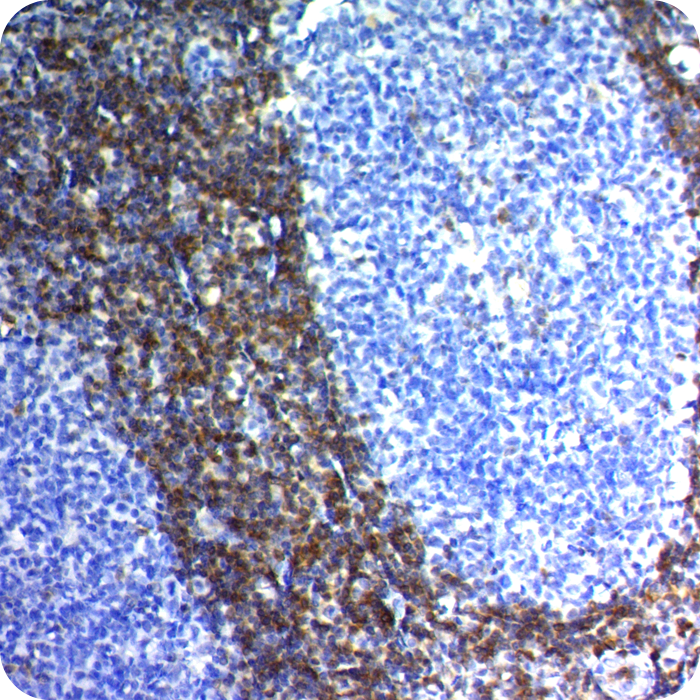 Bcl-2; Clone 100/D5 (Concentrate)